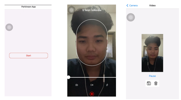 Mobile app screens: start, video recording and playback